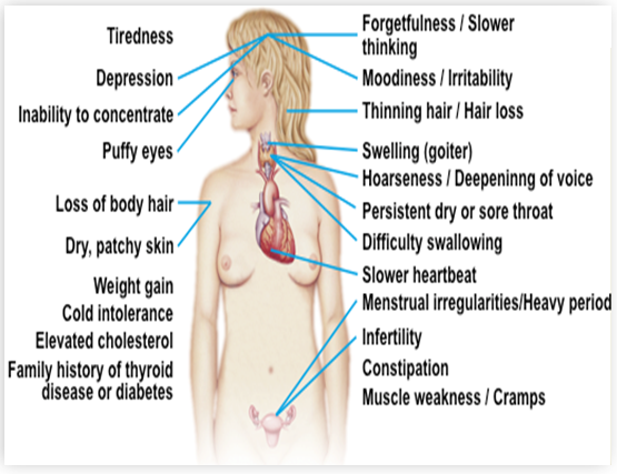 Symptoms-Clinical features-Hypothyroid